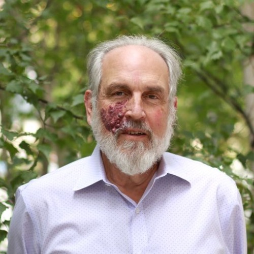 Larry Susskind